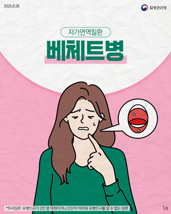 ‘구강궤양-눈염증’ 반복되는 자가면역질환 ‘베체트병’… 의료비 지원 대상 확대