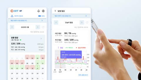 일상 속 혈압 관리의 어려움, ‘카트 비피’로 해소될까